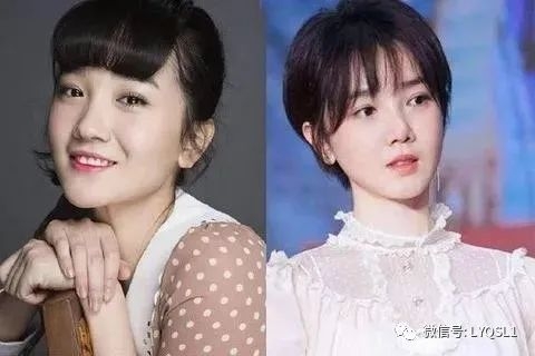 陳小紜整形前後。