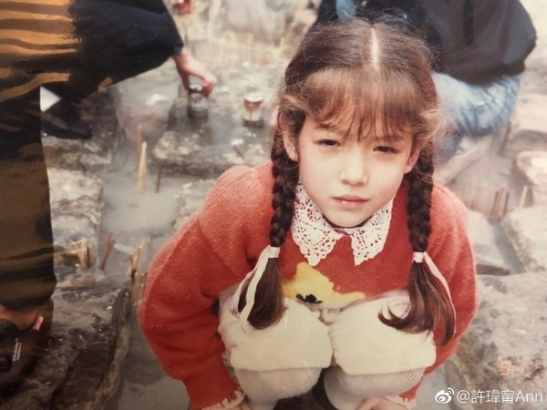 許瑋甯小時候髮色偏紅，混血兒長相卻讓她在童年時期飽受霸凌之苦。