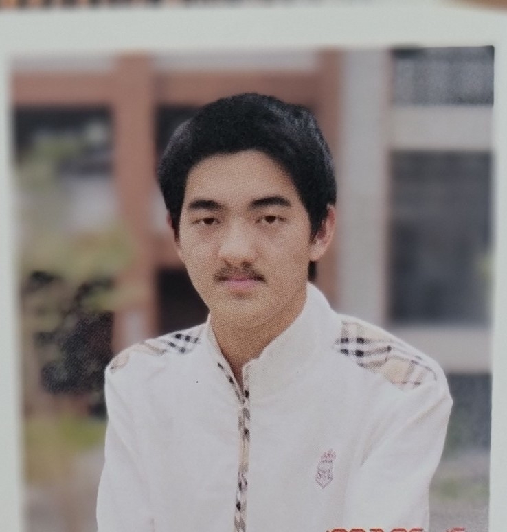 張孝瑜選擇以蓄鬍方式來遮住上唇的痕跡,因為他仍無法完全接納自己