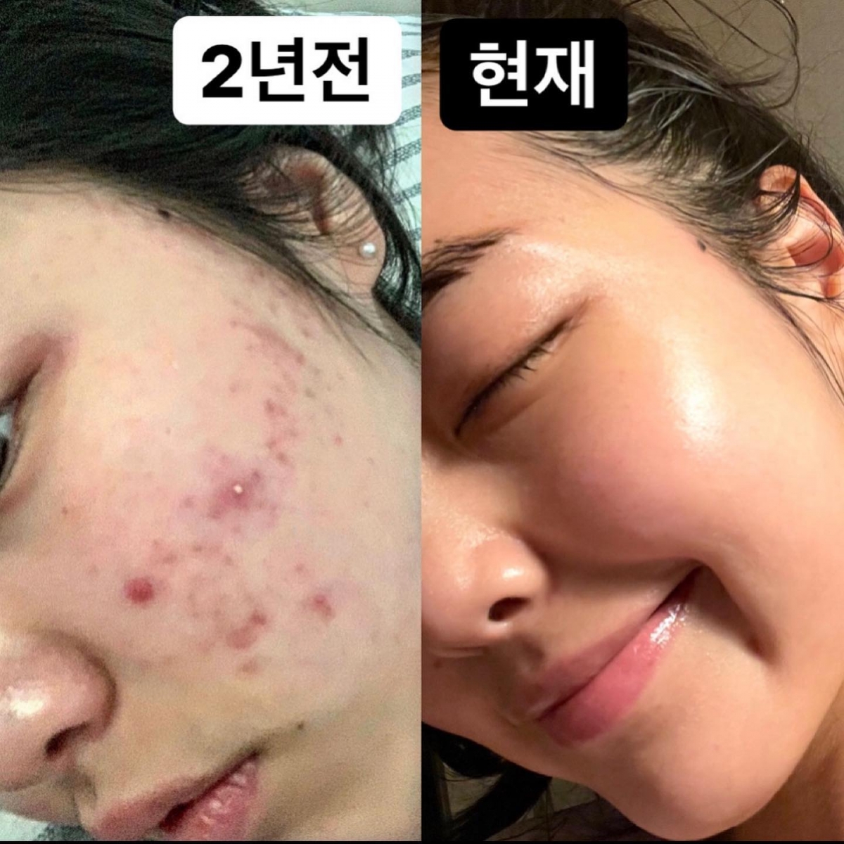 減肥後皮膚也跟著變好