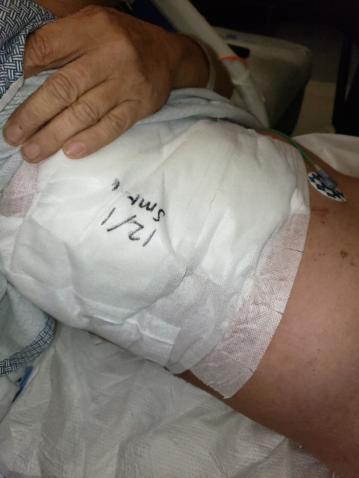 今年59歲的Scott Nelson被醫生救回性命