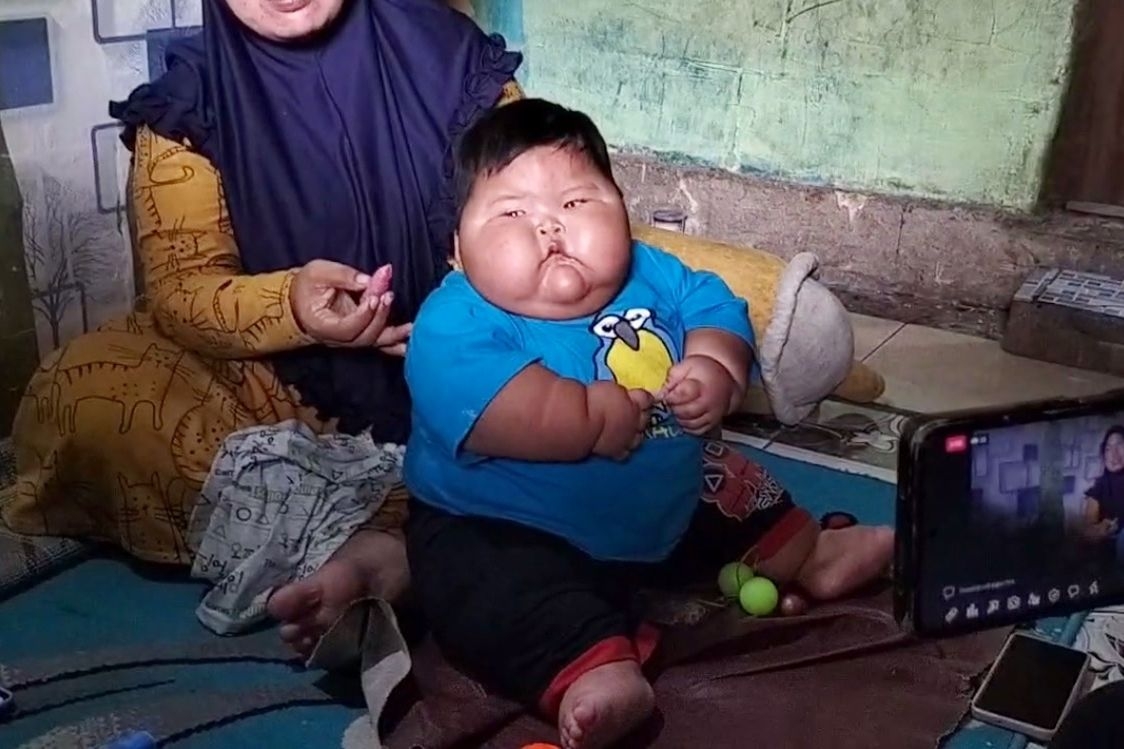印尼巨嬰
