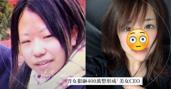 夢想當模特兒！普女被笑「有沒有照過鏡子」，她狠砸400萬整形「25歲逆襲為美女CEO」，她：想幫助跟我一樣的人