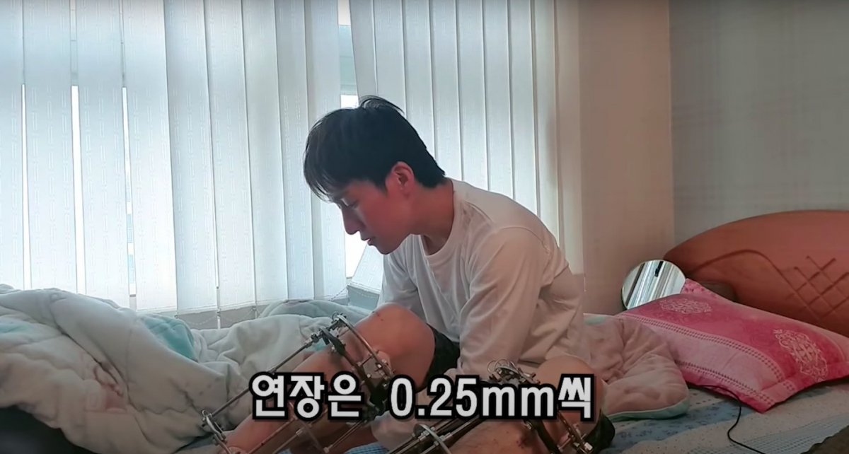 每天調整腳的拉長器