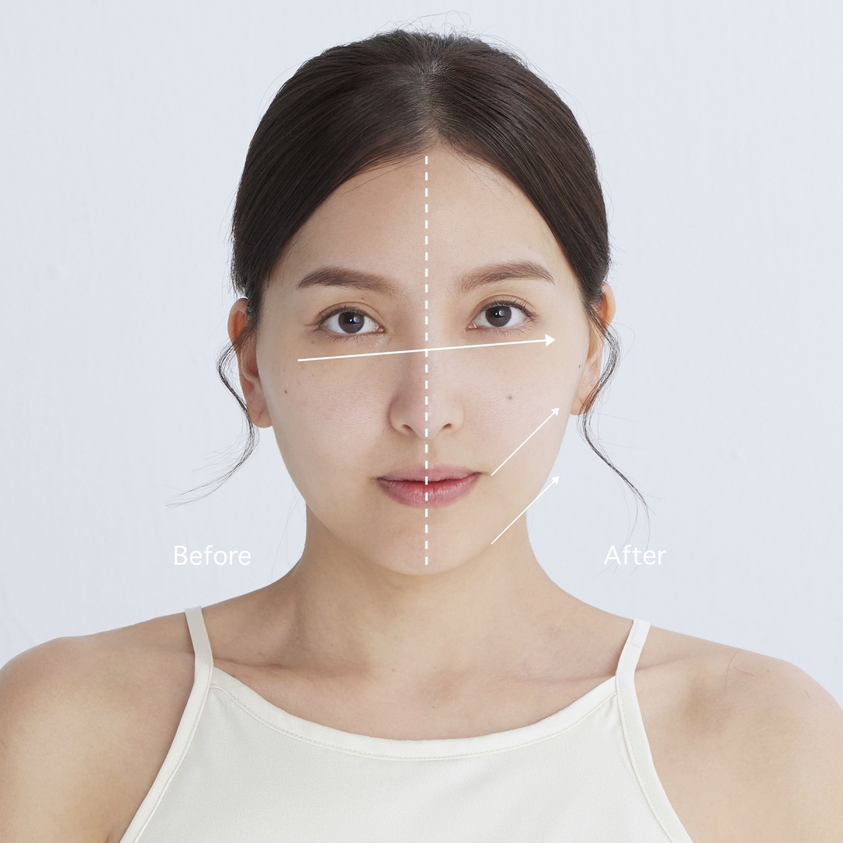 Model使用胜肽青春霜後的拉提緊緻Before/After