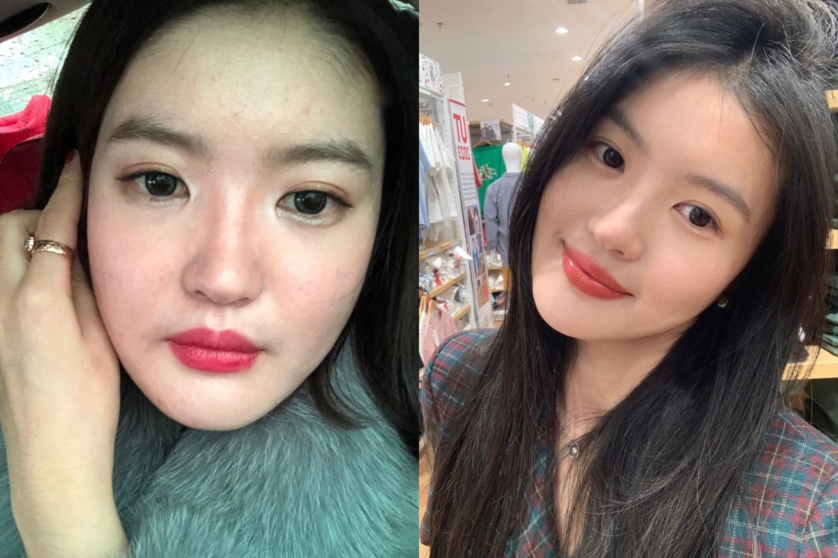 控糖戒糖也不僅是為了皮膚變好,同時也是為了健康和延緩衰老!