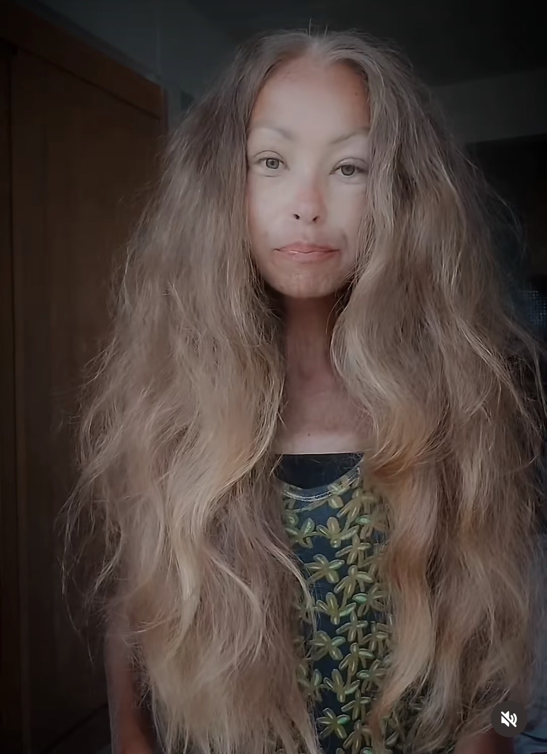 許多網友發現生前的Zhanna D’art頭髮已經如同枯萎的植物