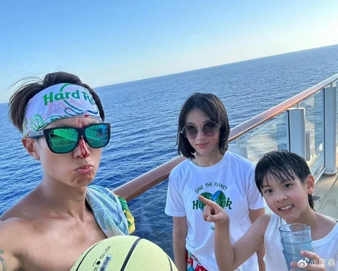 吳尊在歐洲行不慎掛彩。