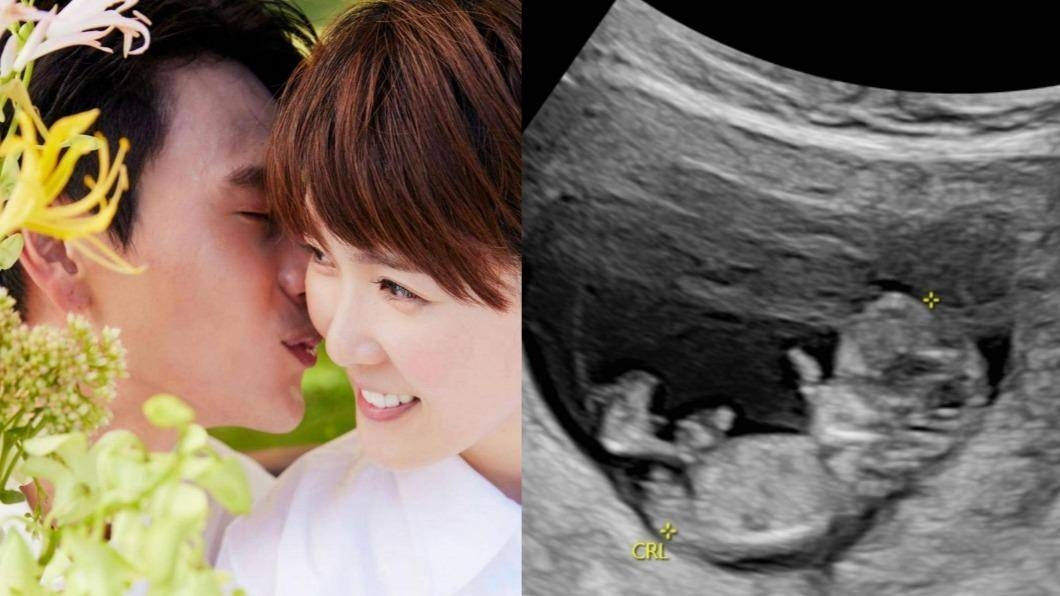 孫可芳肚子裡已懷有小寶寶，小倆口將在今年春季升格為新手父母。