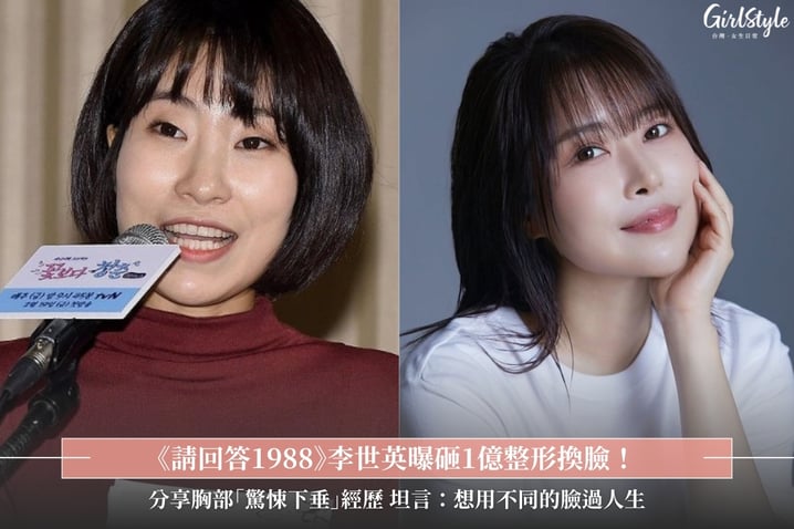 《請回答1988》李世英曝砸1億整形換臉!分享胸部「驚悚下垂」經歷,坦言:想用不同的臉過人生