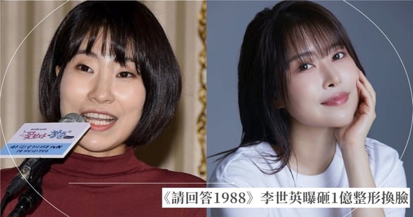 《請回答1988》李世英曝砸1億整形換臉！分享胸部「驚悚下垂」經歷，坦言：想用不同的臉過人生