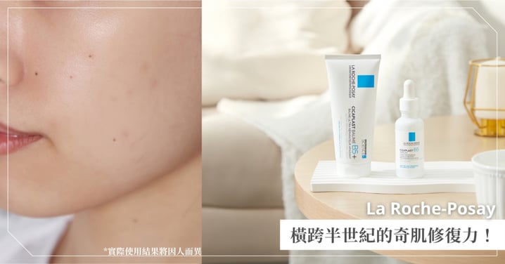 藝人Lulu見證從急救到日常就靠這系列!《理膚寶水》B5萬用霜 & B5繃帶精華,1+1使用擁有橫跨半世紀的奇肌修復力!