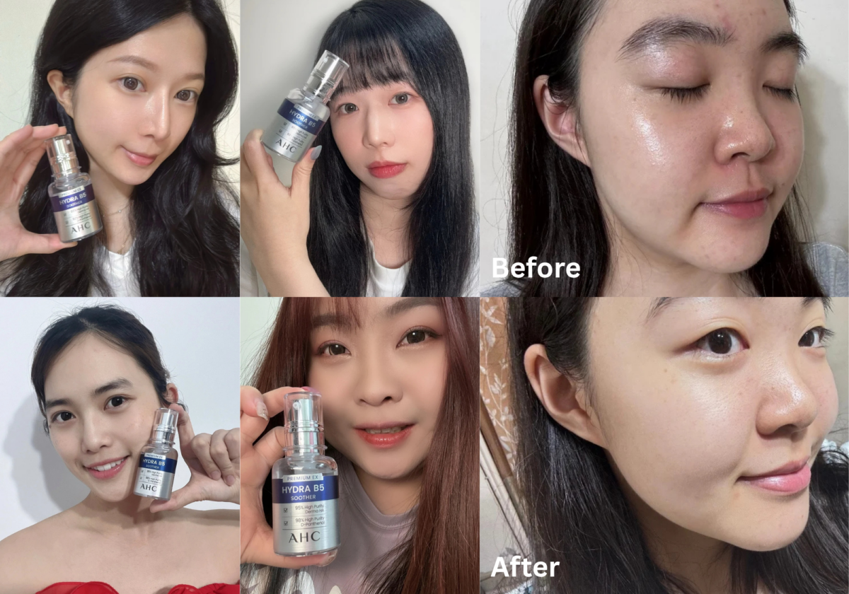 AHC #右旋B5精華 使用前/後對比