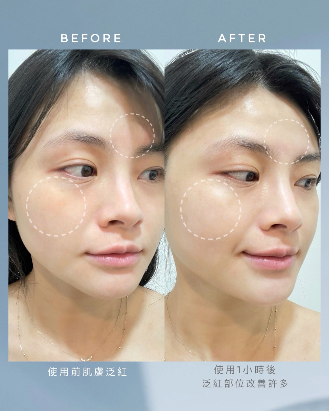 AHC #右旋B5精華 使用前/後對比