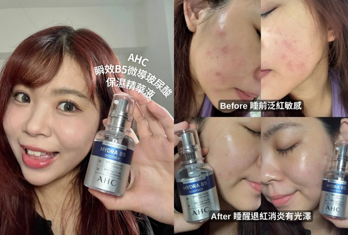 AHC #右旋B5精華 使用前/後對比