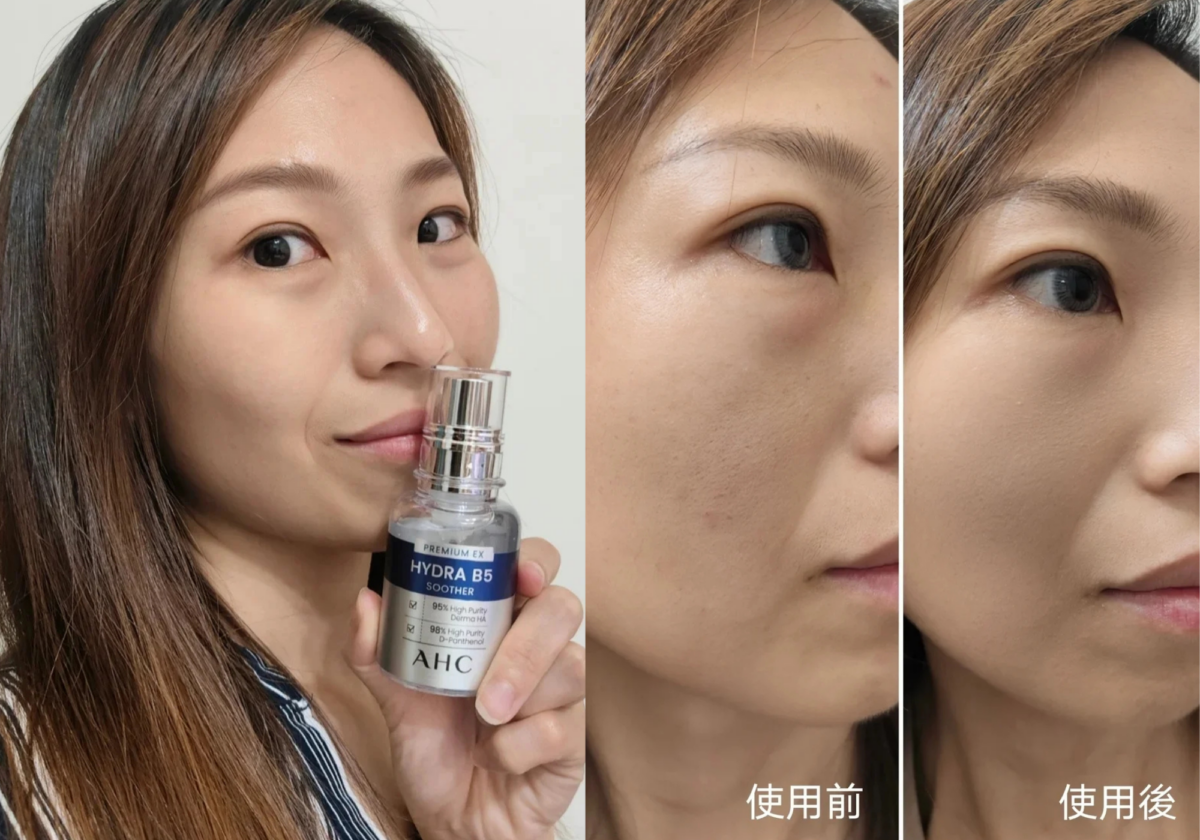 AHC #右旋B5精華 使用前/後對比