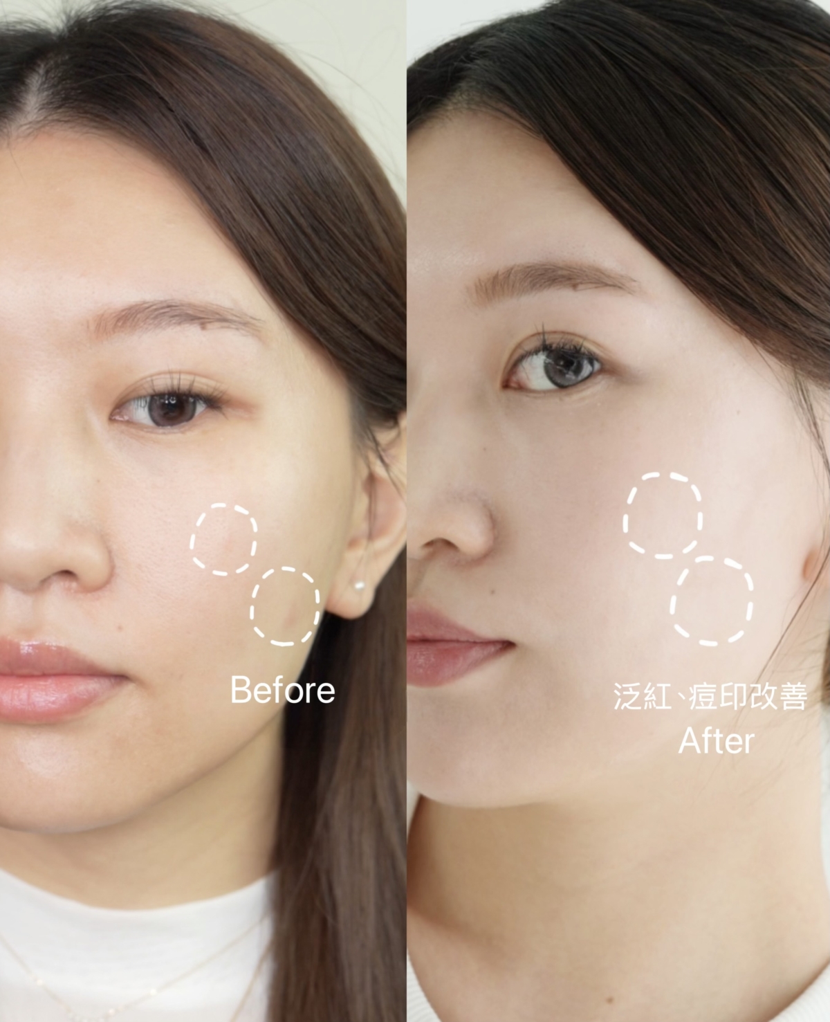 AHC #右旋B5精華 使用前/後對比