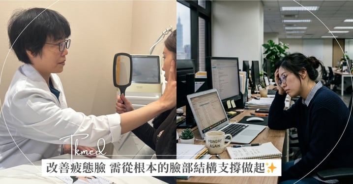 剛開工就被問你累了嗎 醫師：不分年齡 改善疲態臉從這裡下手